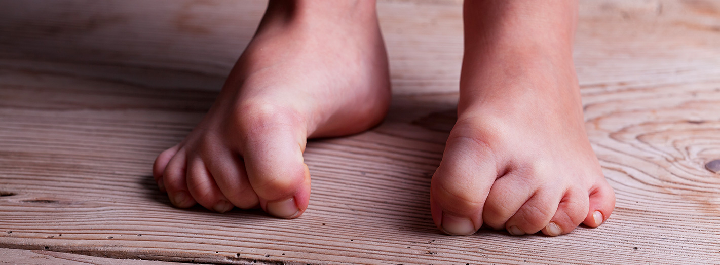 Childrens Podiatry Problems Treated