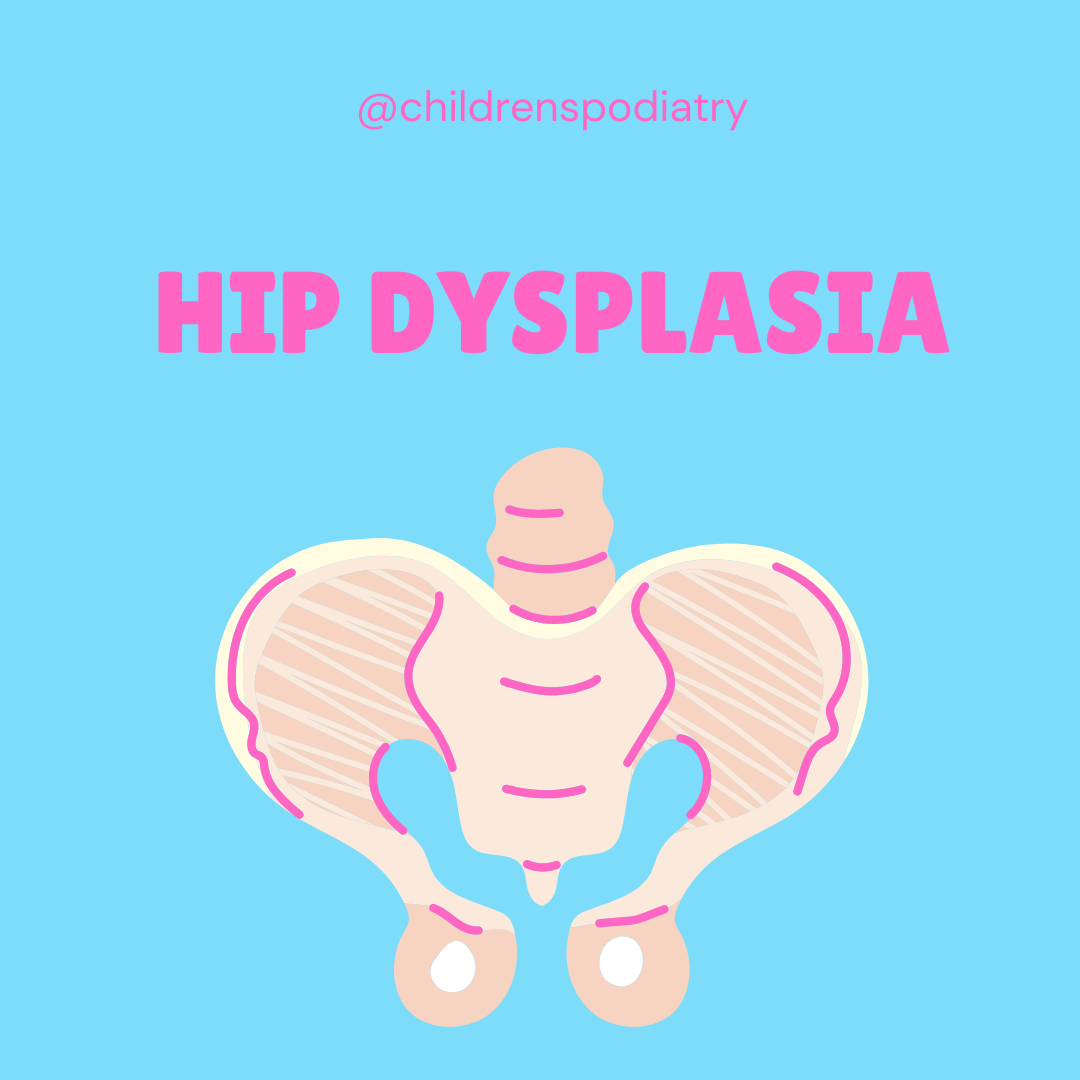 Hip Dysplasia in kids